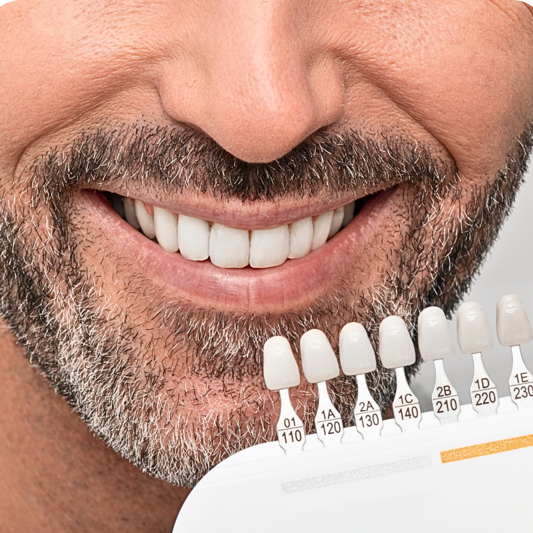 Where to Find London's Best Teeth Whitening Clinics for a Brighter Smile?