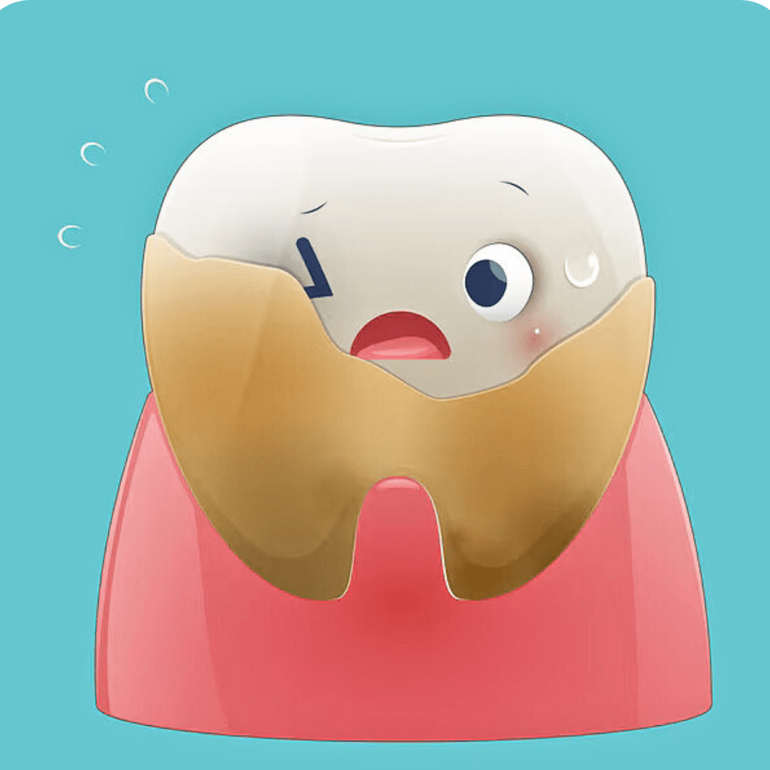 How Does Tartar Form and What Is It? - Prime Oral Care