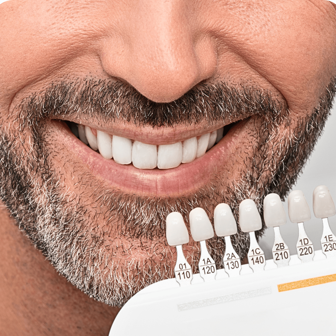 Where to Find London's Best Teeth Whitening Clinics for a Brighter Smile? - Prime Oral Care