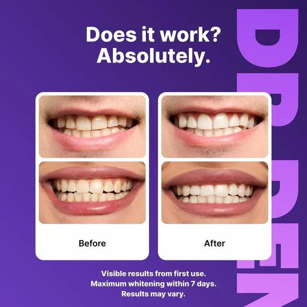 5D Teeth Whitening Strips - Prime Oral Care