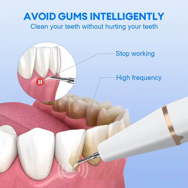 Ultrasonic    Dental Cleaner