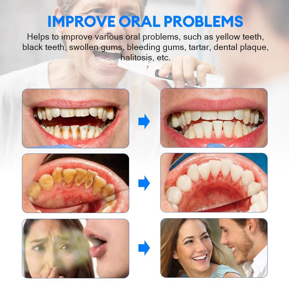 Portable ultrasonic dental cleaner, lightweight and powerful, designed for deep cleaning and maintaining healthy teeth and gums