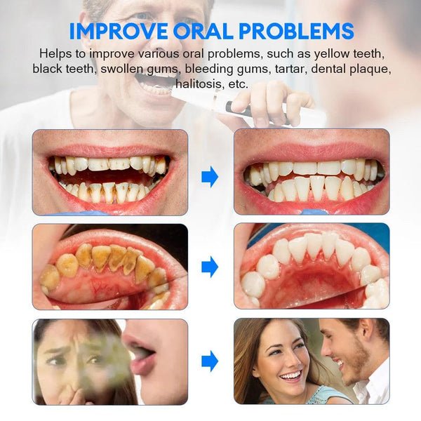 Portable ultrasonic dental cleaner, lightweight and powerful, designed for deep cleaning and maintaining healthy teeth and gums
